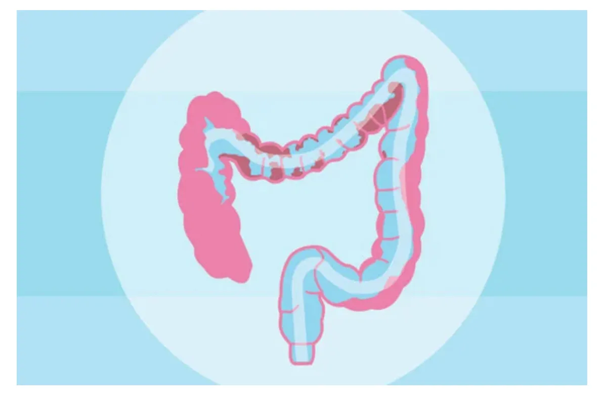 Colon Cleanses and Enemas