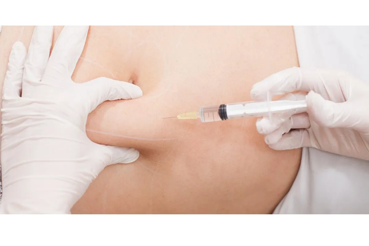 Costs and Factors of Fat Dissolving Injections