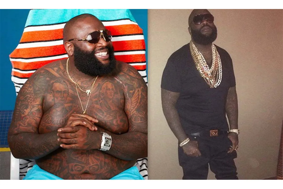 Rick Ross Weight Loss Surgery
