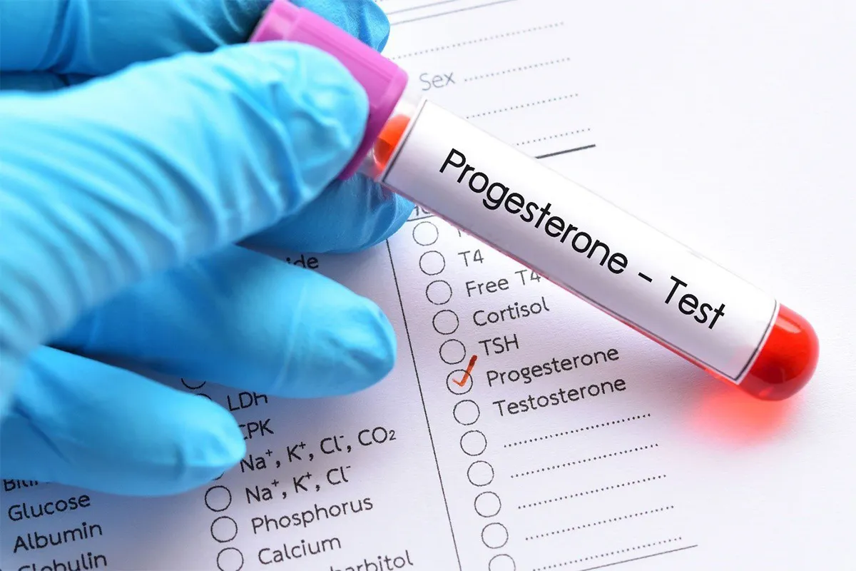 Testing Progesterone Levels