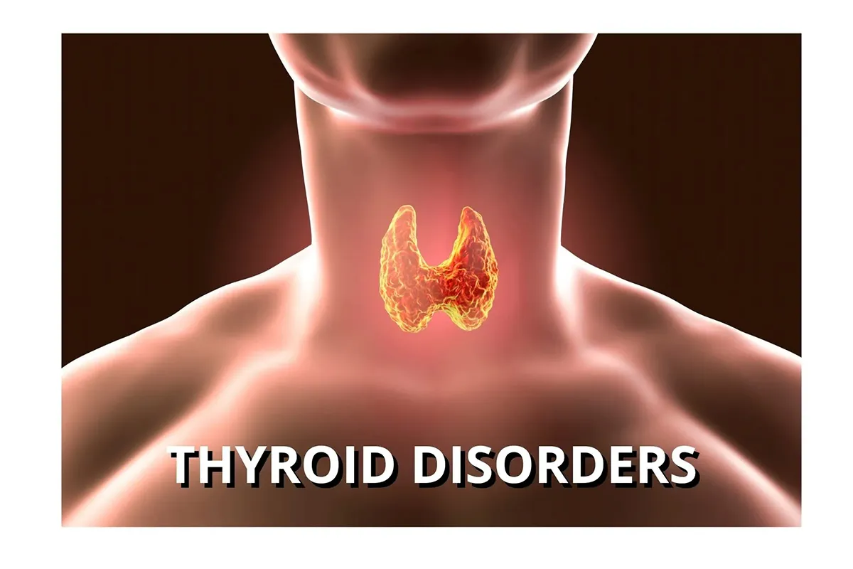 Thyroid dysfunction