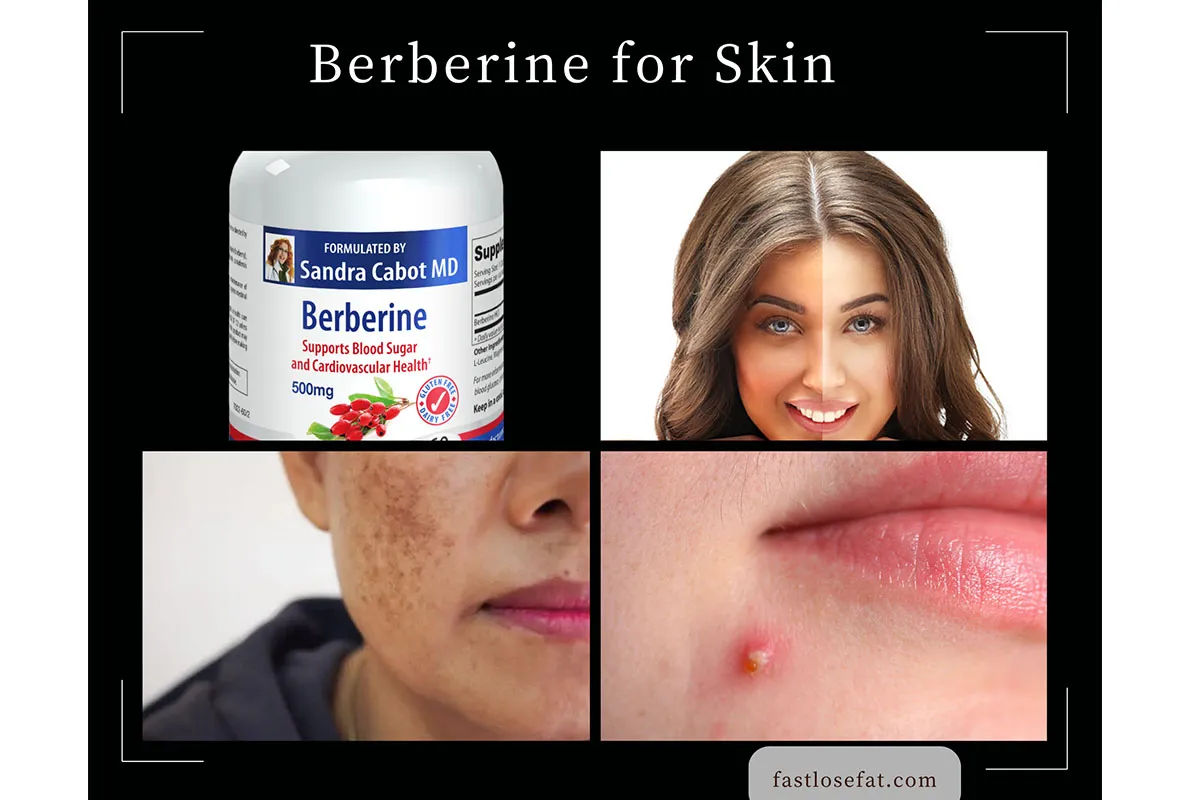 Berberine for Skin