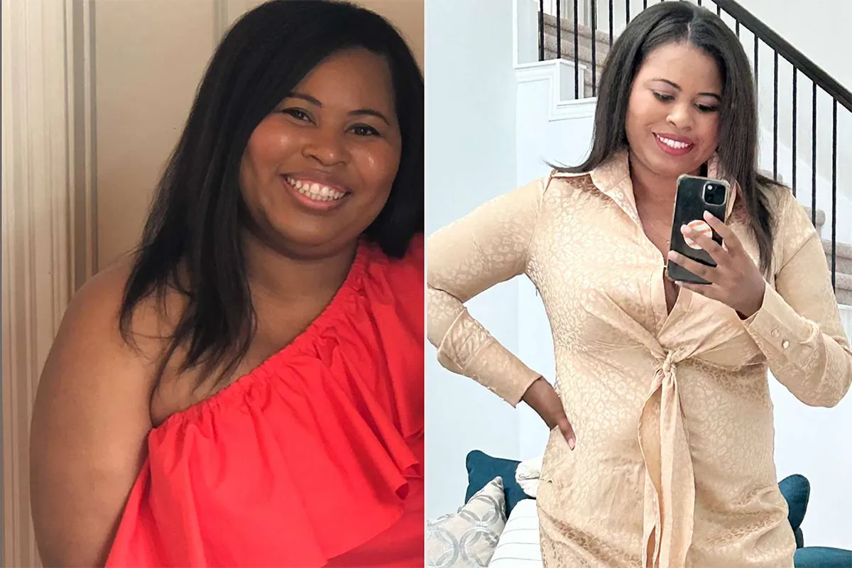 Mounjaro Weight Loss Before and After Pictures