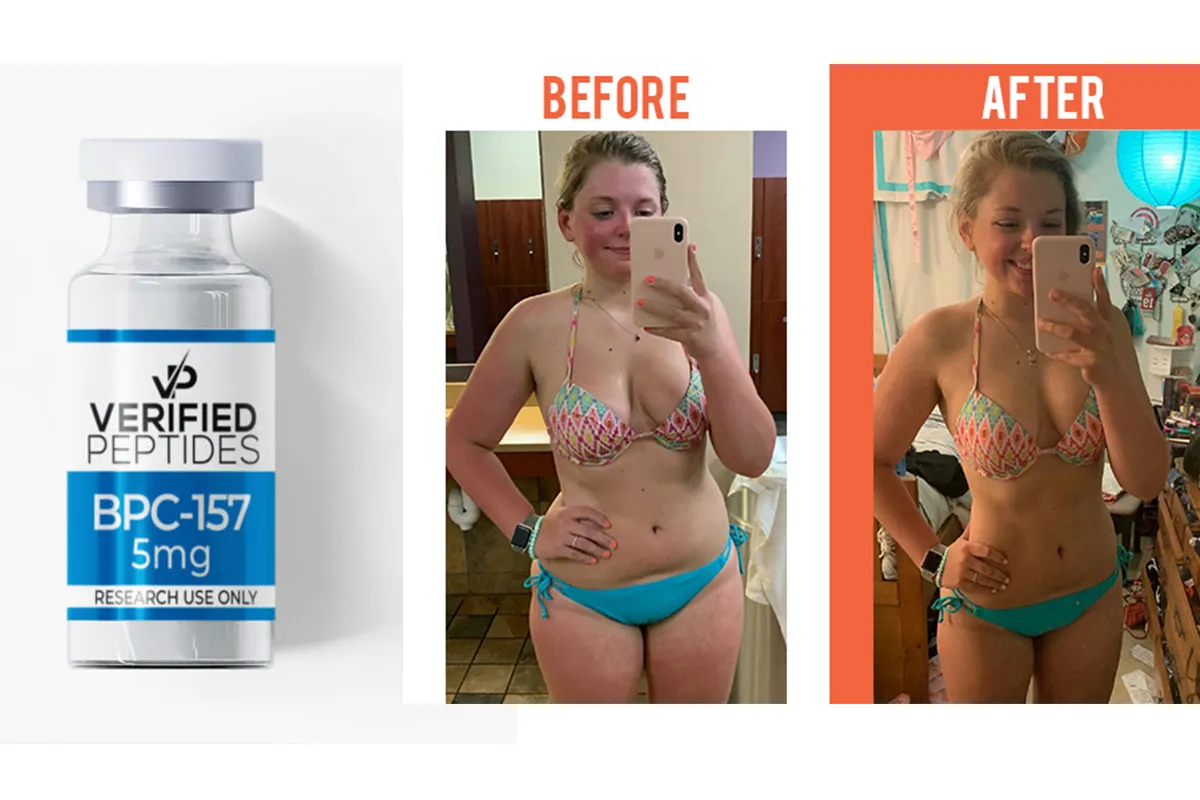 Peptide Weight Loss Near Me