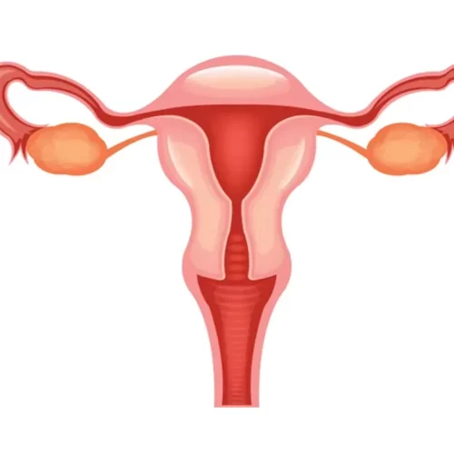 Types of Menstrual Disorders